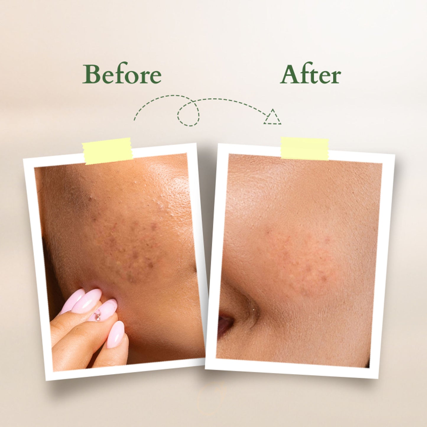 Lotus Organics Vit-C Radiance Booster Cleanser - Lemon Verbena