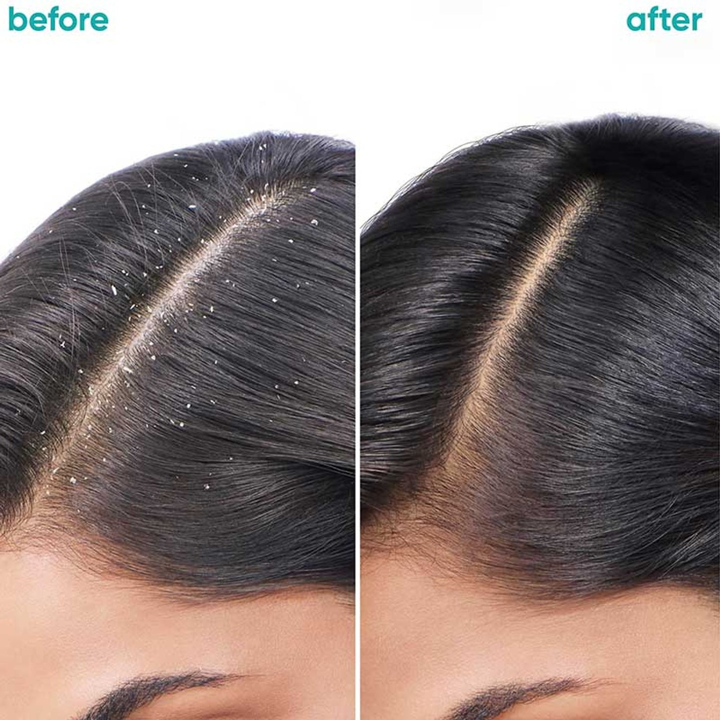 Biolage Aminexil Hair Treatment Pack, Reduces Hair Loss from Roots, 10x6ml