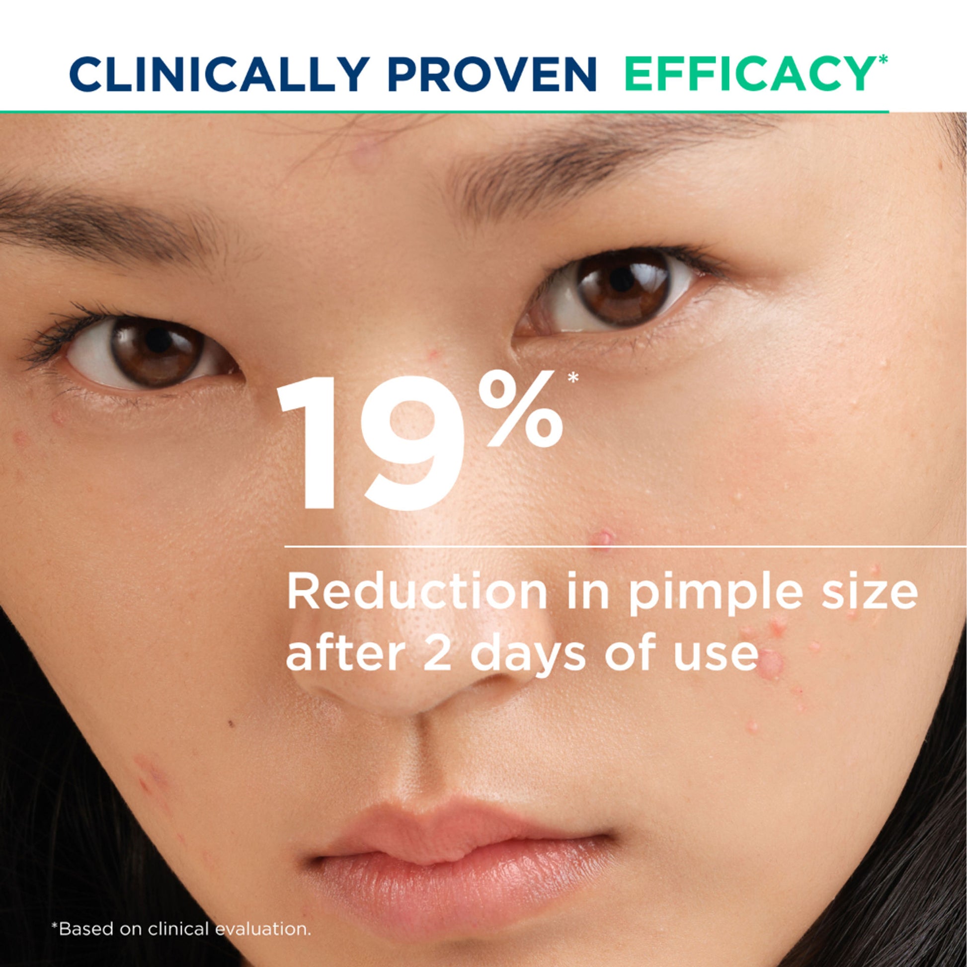 Bioderma Anti-Blemish Gel Cream - Sebium Kerato+ Spot Corrector - Eliminates Pimples & Blackheads