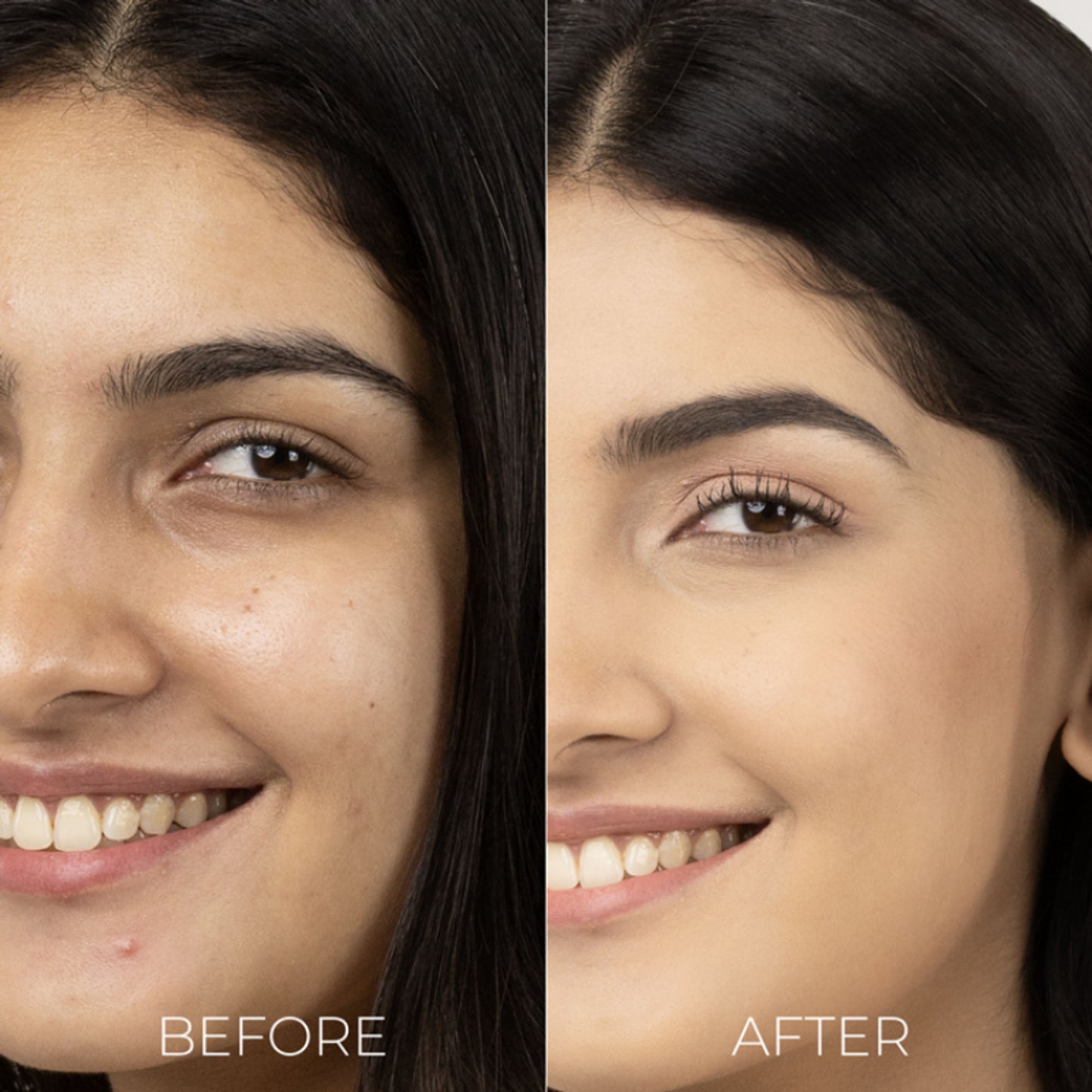 Brillare Skin Brightening Moisturizers For Reducing Pigmentation
