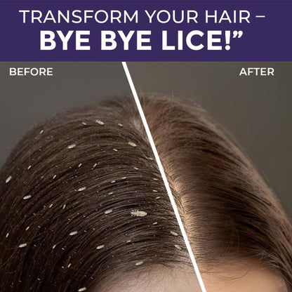 Sanfe Anti Lice & Dandruff Shampoo