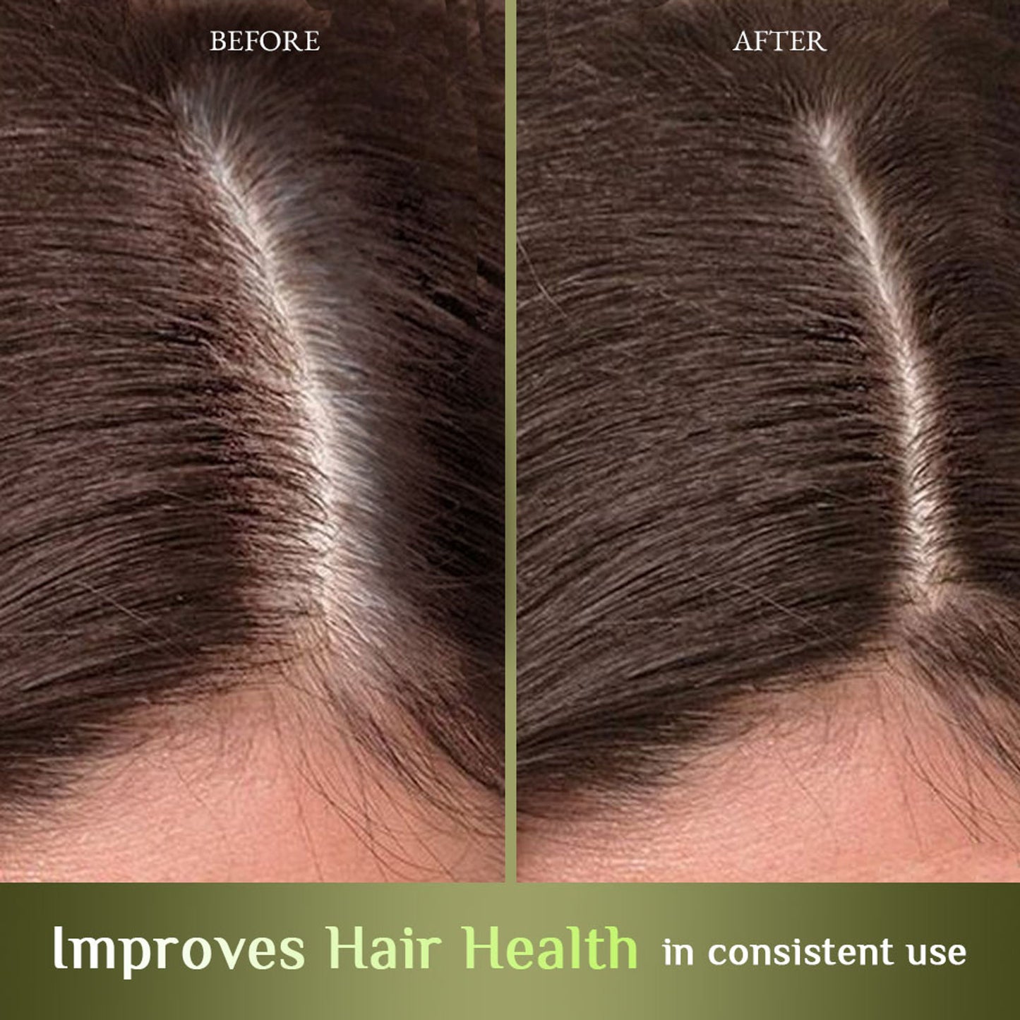Richfeel Hair Nourisher Oil - Hair Fall Control & Growth Treatment, Trichologist-Developed Formula
