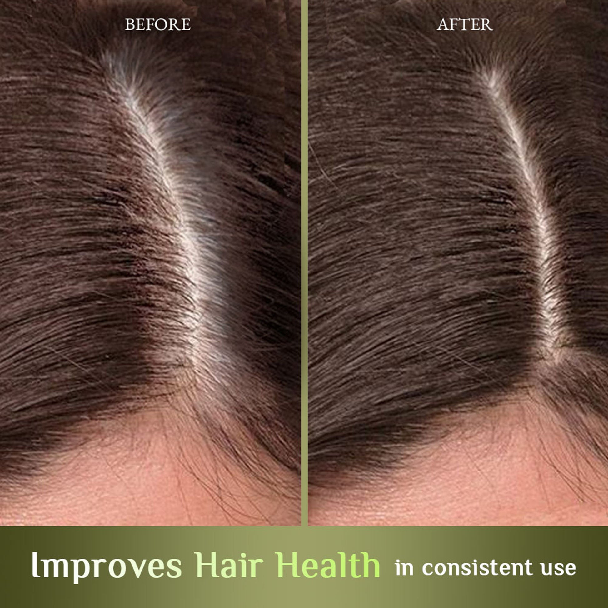 Richfeel Hair Nourisher Oil - Hair Fall Control & Growth Treatment, Trichologist-Developed Formula