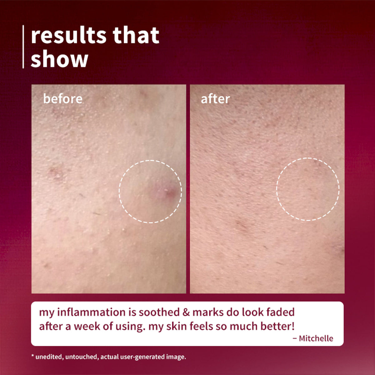 Plum Black Rice & Niacinamide-TXA 10% Night Clarity Jelly Serum