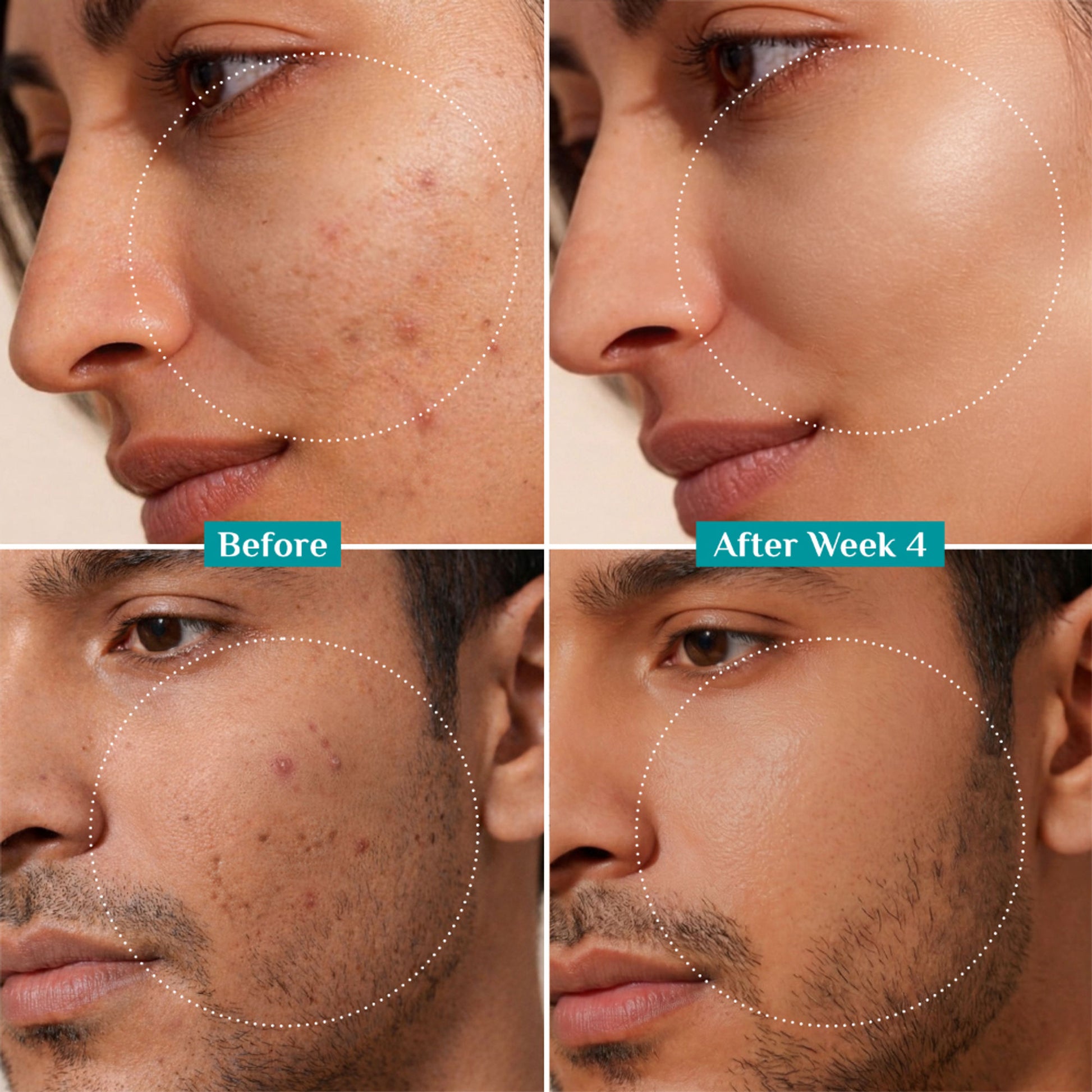 Pilgrim 10% Niacinamide with Kojic Acid & Korean Rice Water Face Serum For Clear Glass Skin Glow