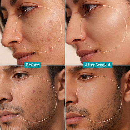 Pilgrim 10% Niacinamide with Kojic Acid & Korean Rice Water Face Serum For Clear Glass Skin Glow