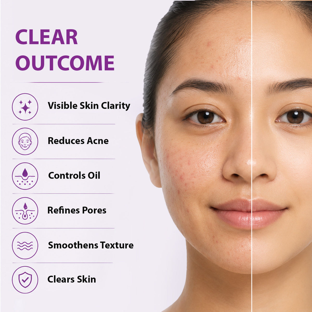 DERMISTRY 2% Salicylic Acid and 5% Niacinamide face serum for oily, acne-prone skin, open pores, and spot scars.