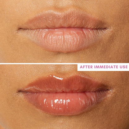 The Skin Diet Company Glossy Lip Barrier Oil To Repair & Protect Dry & Pigmented Lips