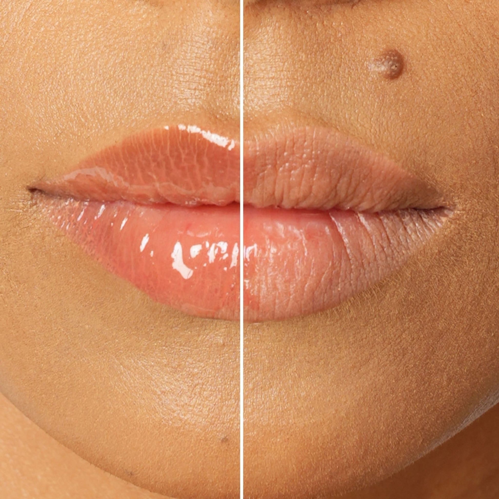 The Skin Diet Company Glossy Lip Barrier Oil To Repair & Protect Dry & Pigmented Lips
