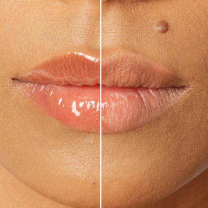 The Skin Diet Company Glossy Lip Barrier Oil To Repair & Protect Dry & Pigmented Lips