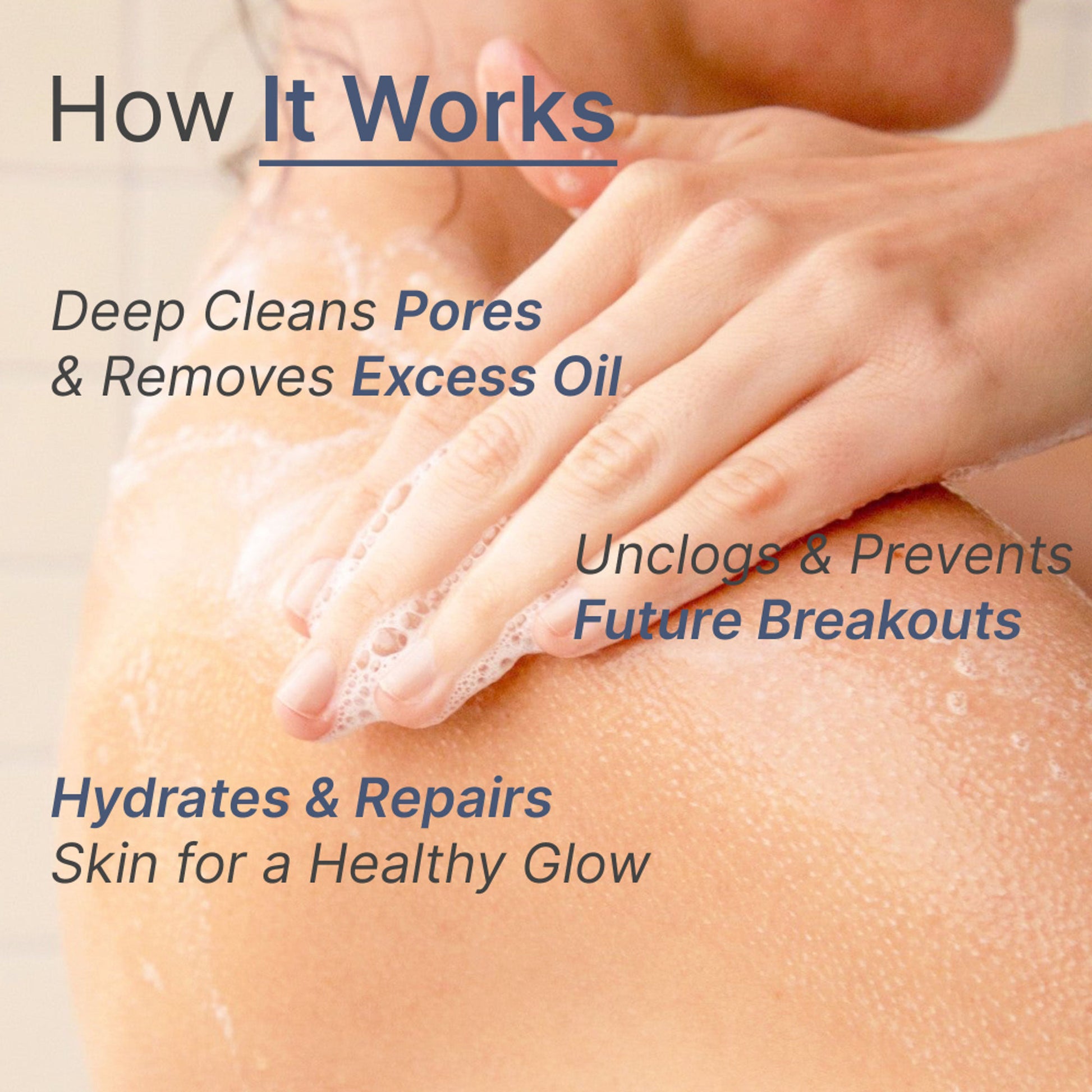 Wild Oak 5% Benzoyl Peroxide Face & Body Acne Wash