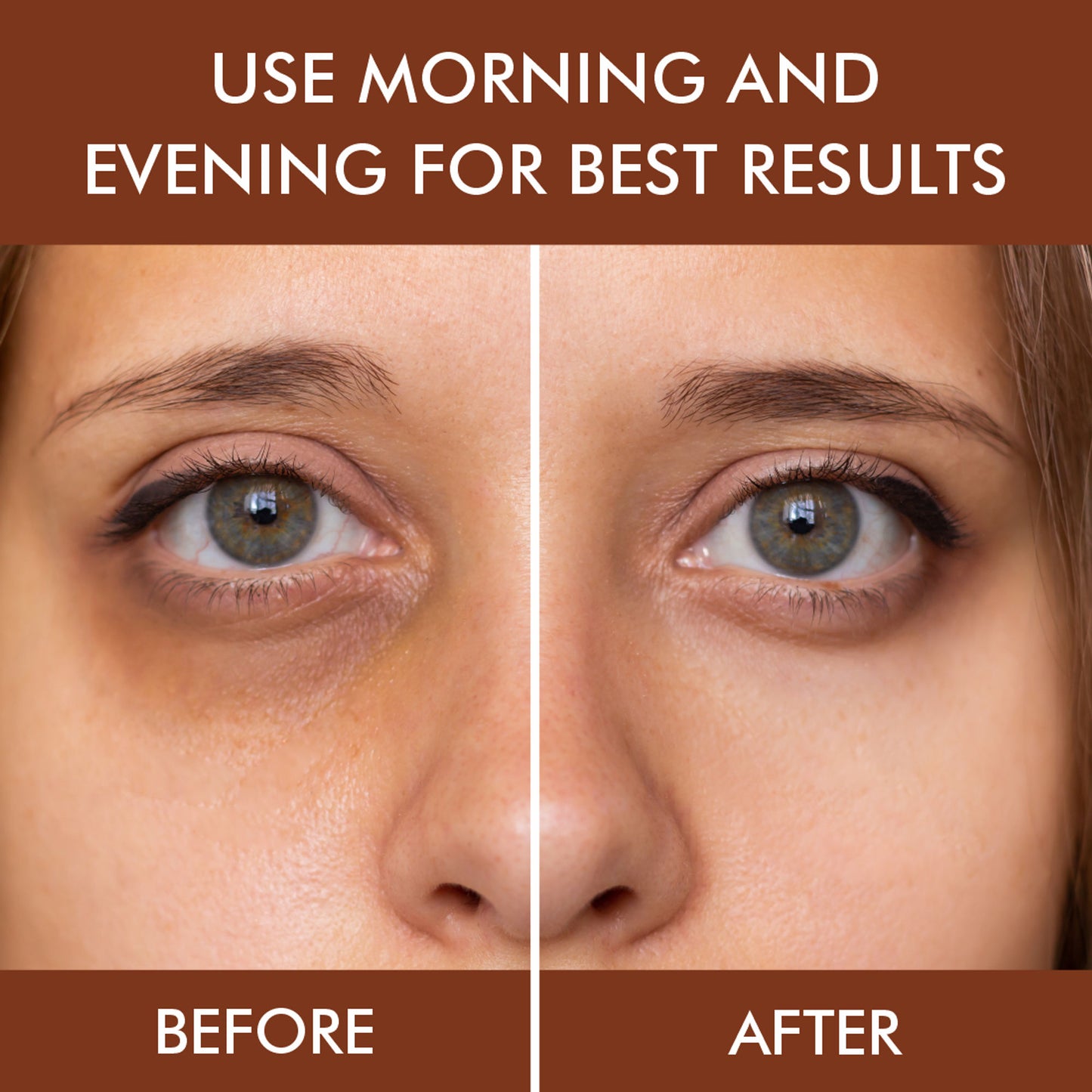 Nuerma Science Under Eye Gel for Dark Circles Removal