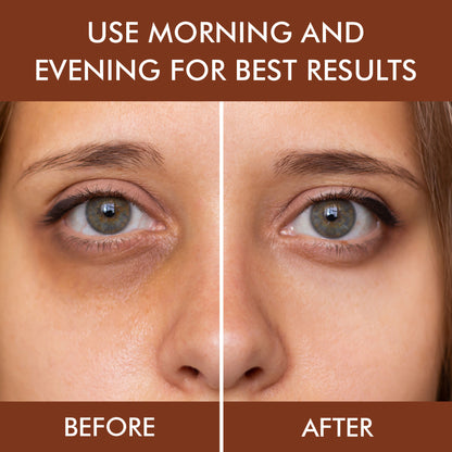 Nuerma Science Under Eye Gel for Dark Circles Removal