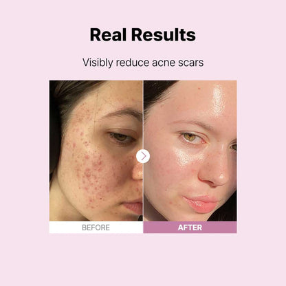 COSRX The Niacinamide 15 Serum