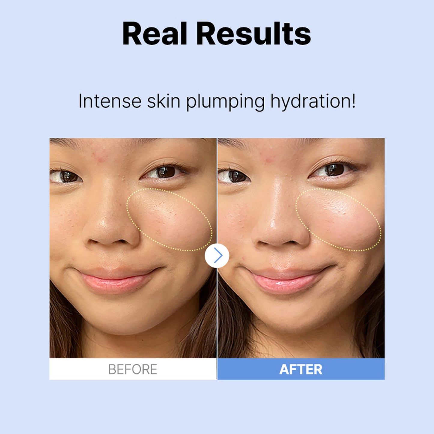 COSRX The Hyaluronic Acid 3 Serum