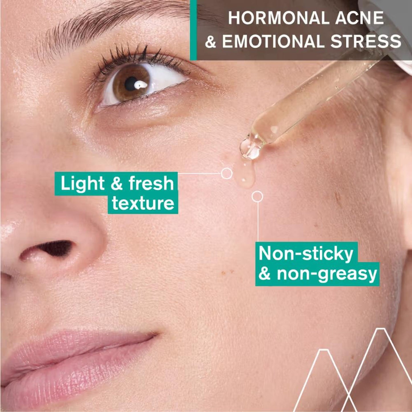 Uriage Hyseac Skin Anti-Blemish Serum 5.8% AHA for Hormonal Peak & Stress Acne Dermat Recommended