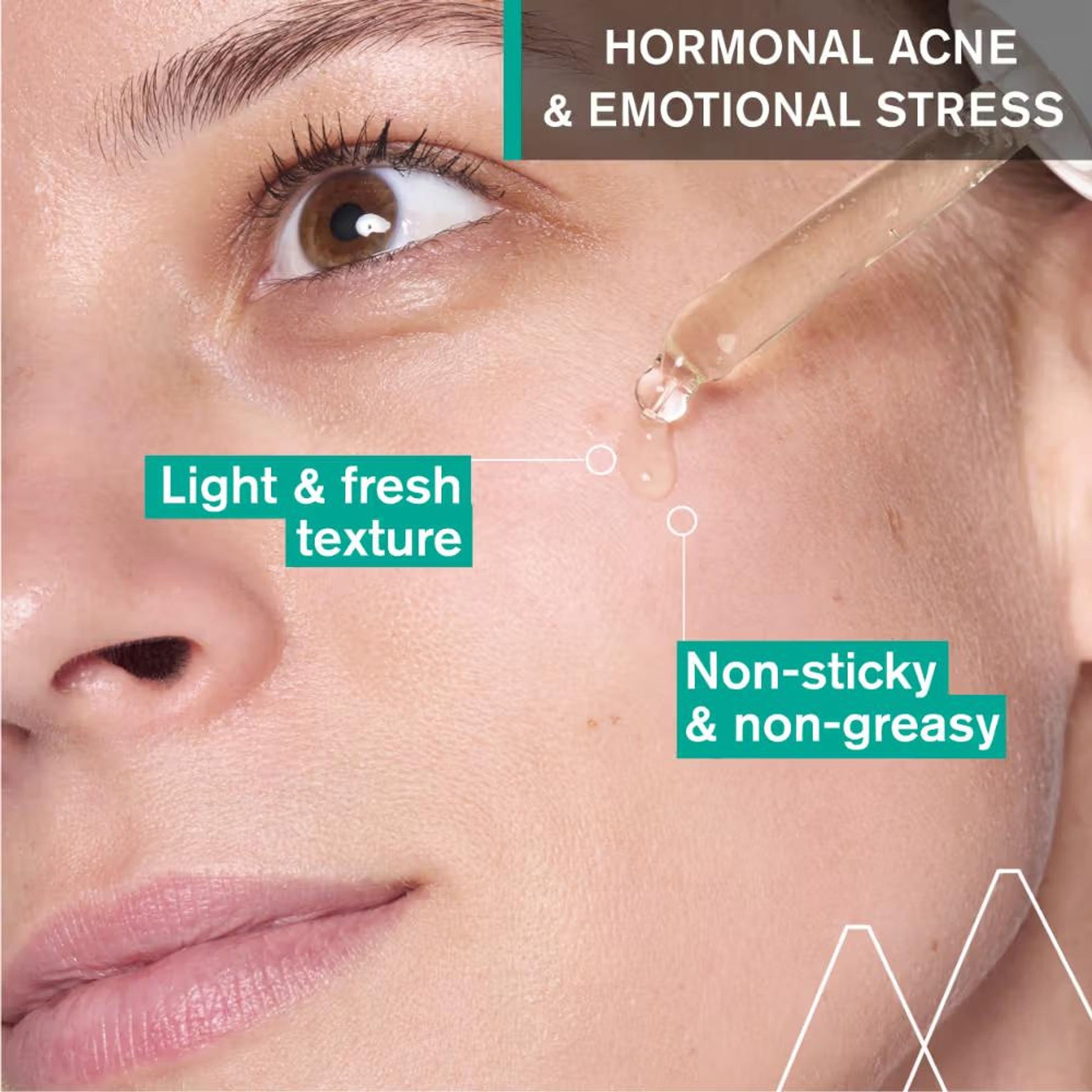 Uriage Hyseac Skin Anti-Blemish Serum 5.8% AHA for Hormonal Peak & Stress Acne Dermat Recommended