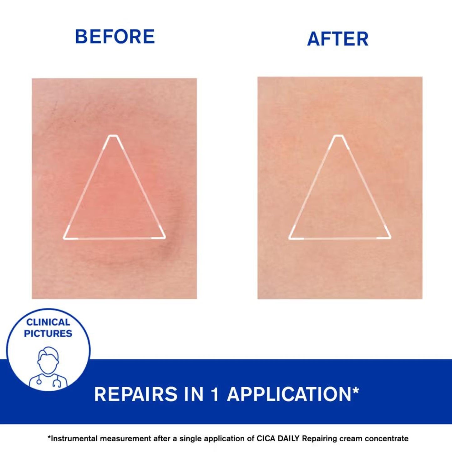 Uriage Cica-Daily Intense Repairing Anti-Pollution Serum 10.5% Thermal Biotic Complex Repairs Skin