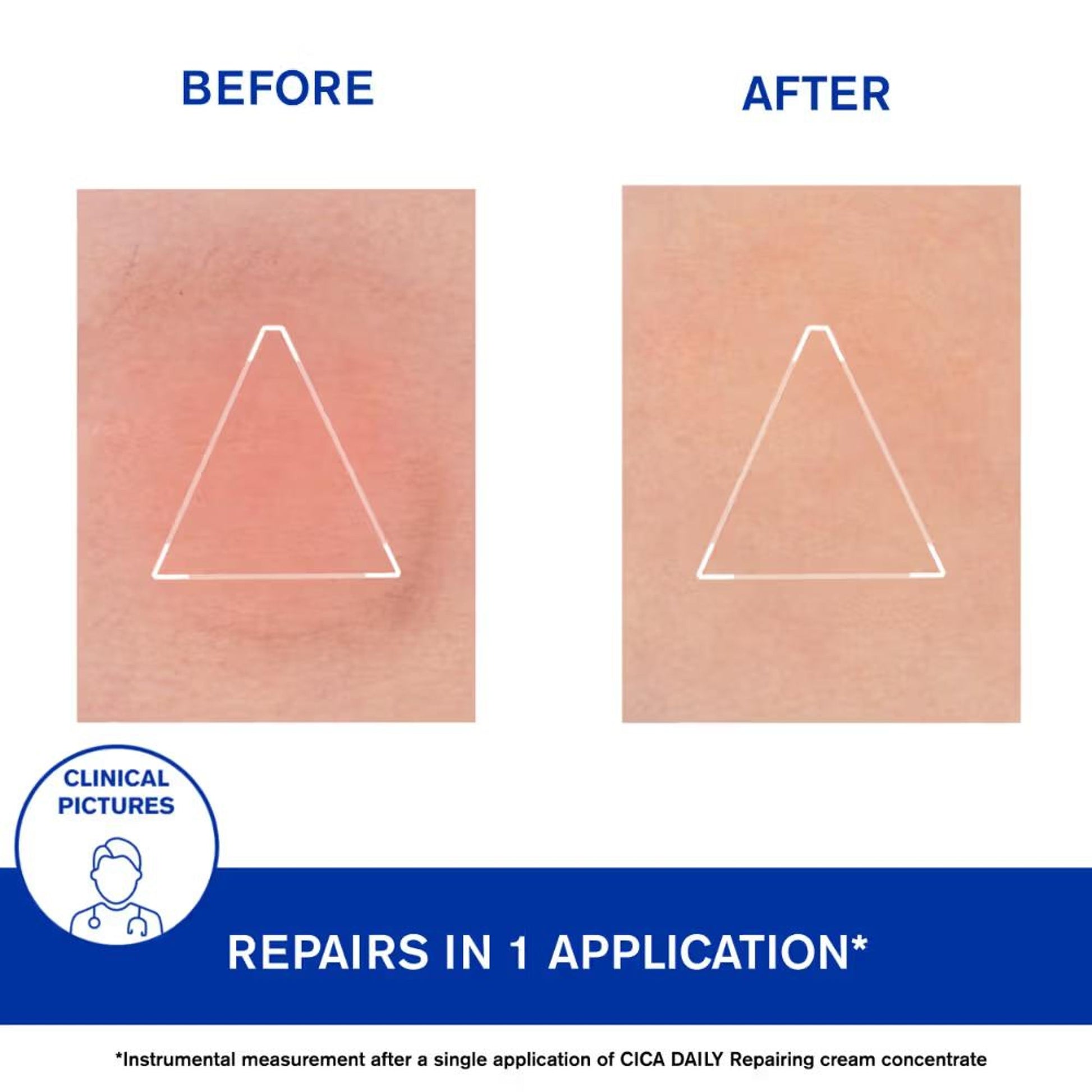 Uriage Cica-Daily Intense Repairing Anti-Pollution Serum 10.5% Thermal Biotic Complex Repairs Skin