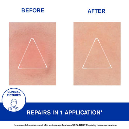 Uriage Cica-Daily Intense Repairing Anti-Pollution Serum 10.5% Thermal Biotic Complex Repairs Skin