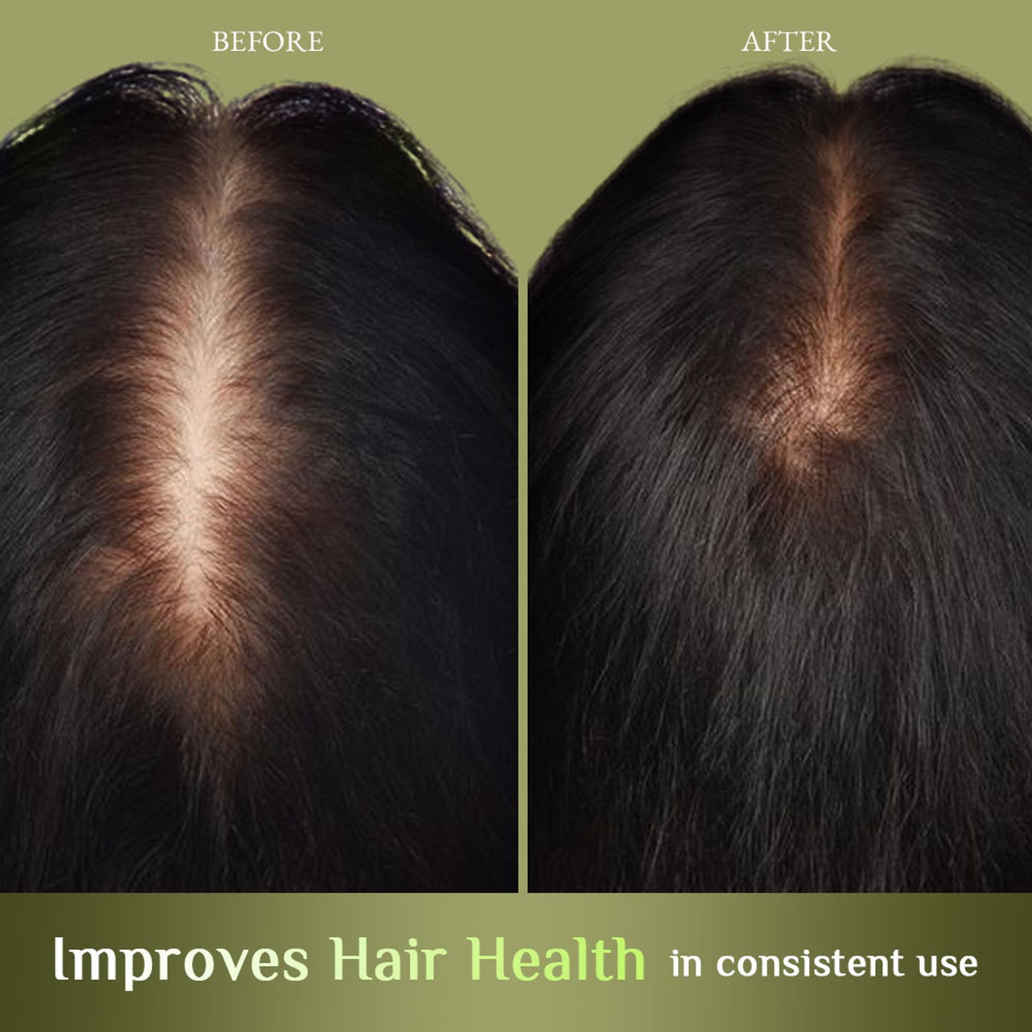 Richfeel Brahmi Jaborandi Hair Oil - Strengthens, Nourishes, Promotes Growth & Soothes Scalp