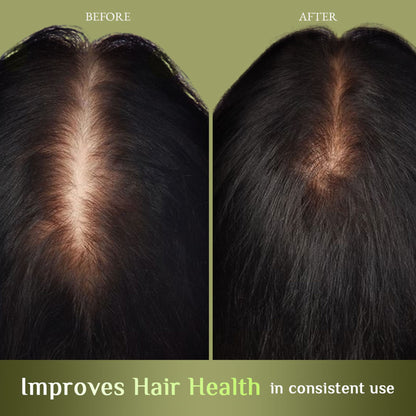 Richfeel Brahmi Jaborandi Hair Oil - Strengthens, Nourishes, Promotes Growth & Soothes Scalp
