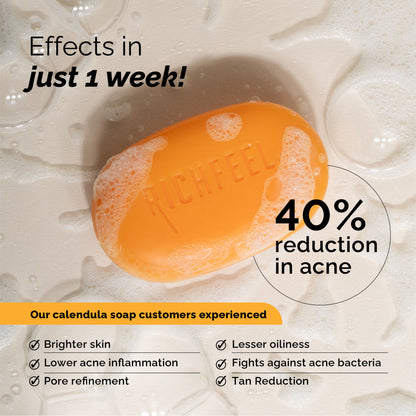 Richfeel Calendula Anti-Acne Soap: Fights Pimples, Blemishes & Promotes Healthy, Luminous Skin