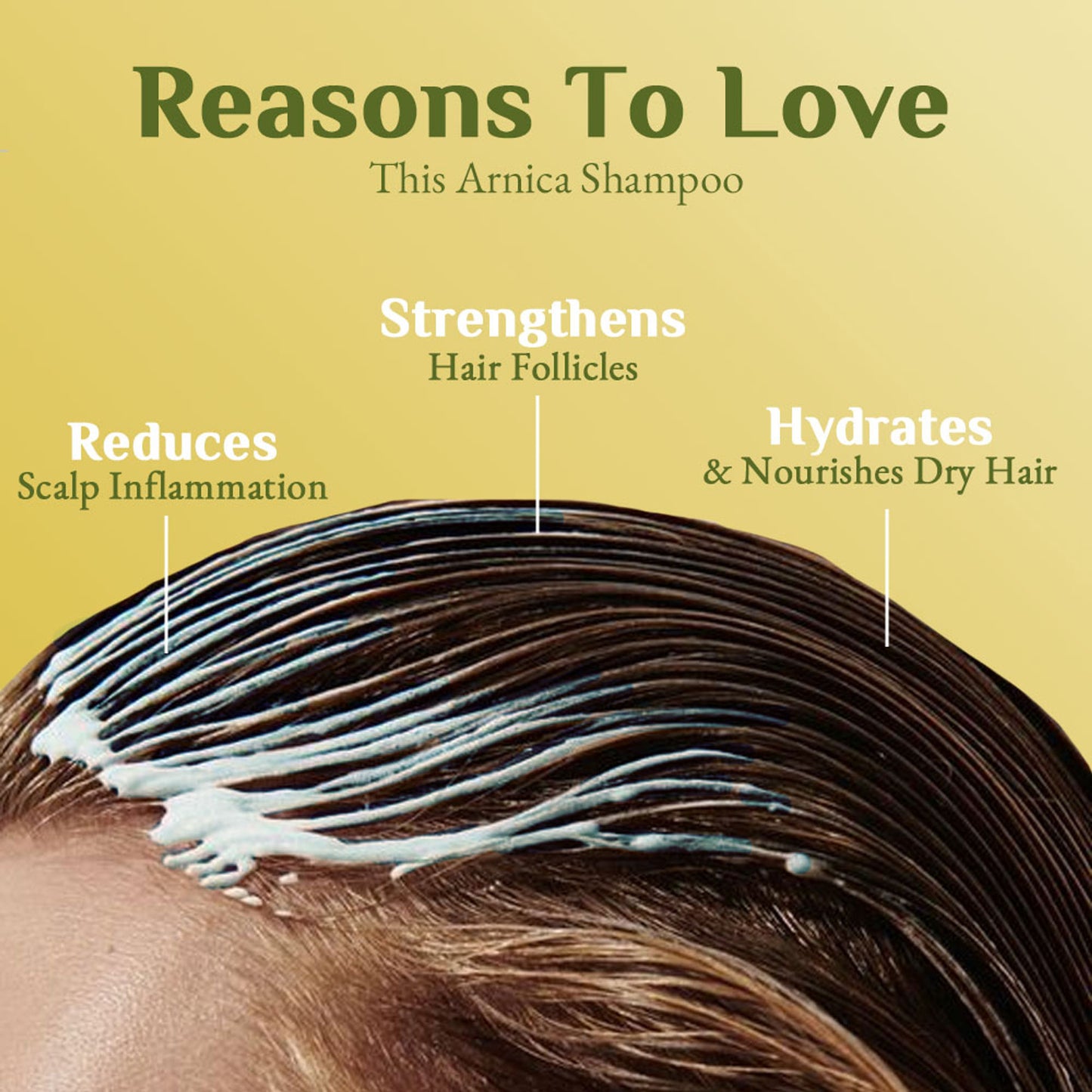 Richfeel Arnica Anti-Dandruff Shampoo - Clears Flakes, Relieves Oil, Soothes Itching