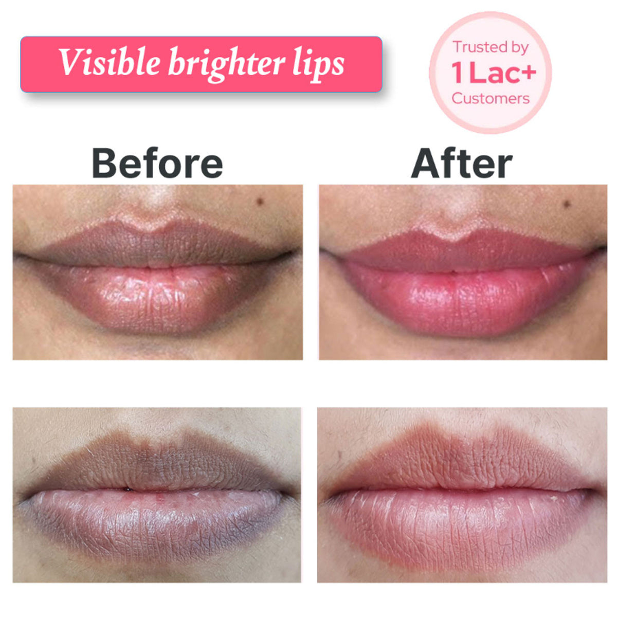ALANNA Lip Wash brightening lip cleanser for dark, dry, and pigmented lips, designed for women to enhance lip brightness and cleanliness.