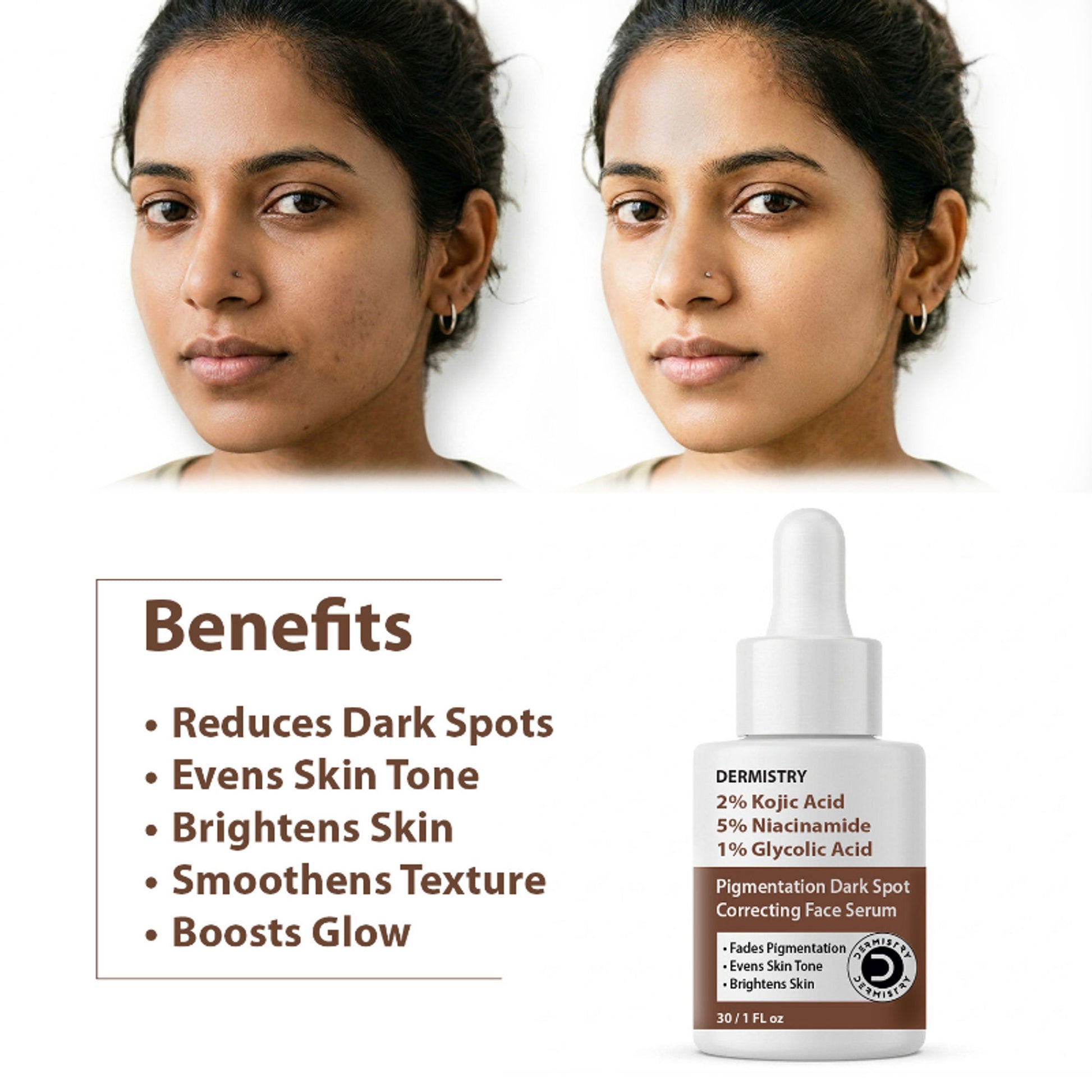 DERMISTRY 2% Kojic Acid Face Serum Pigmentation Dark Spots Removal Whitening Glowing Skin Fairness