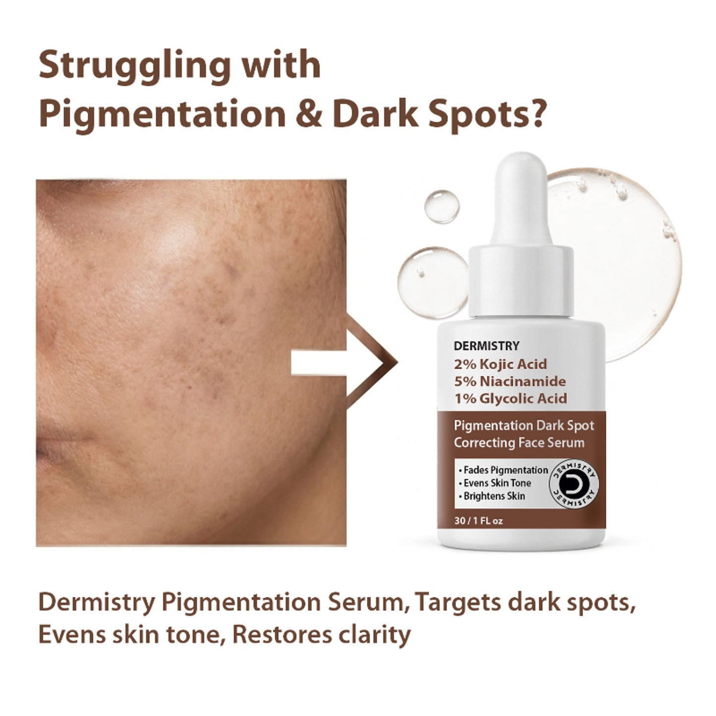 DERMISTRY 2% Kojic Acid Face Serum Pigmentation Dark Spots Removal Whitening Glowing Skin Fairness