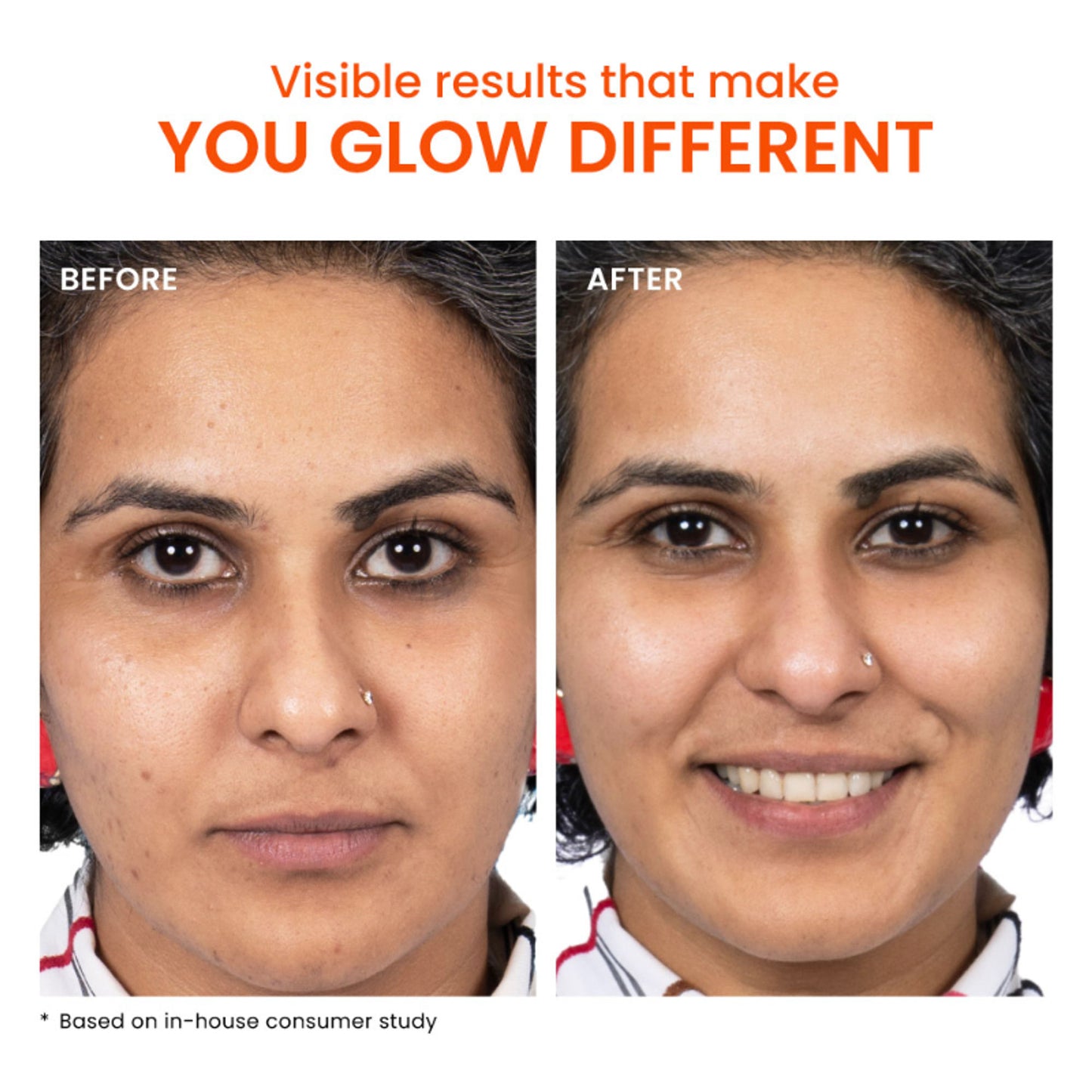 Foxtale Cell Renewal Serum - with Collagen, PDRN, PGA & Niacinamide