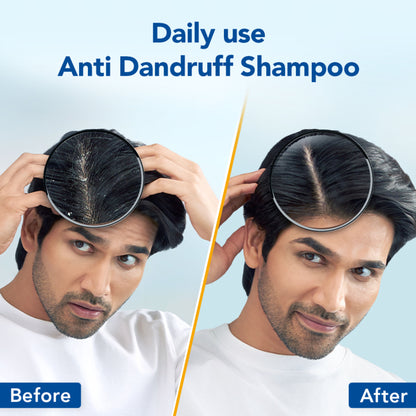 Scalpe Pro Daily Use Anti-dandruff shampoo with Climbazole & ZPTO for dandruff free scalpe