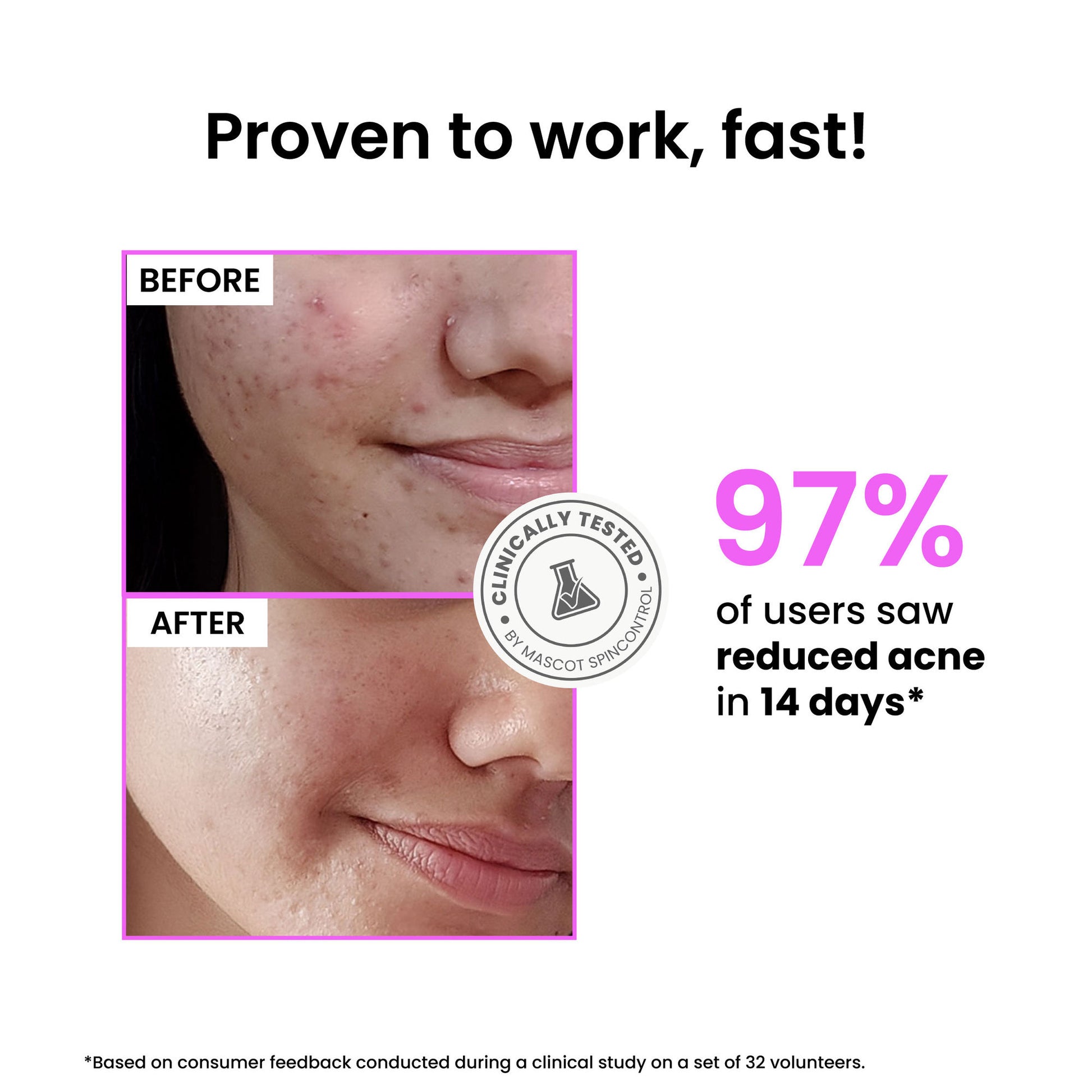 Foxtale 12% Niacinamide Brightening Face Serum, Fades Dark Spots & Acne marks, For Oil Control