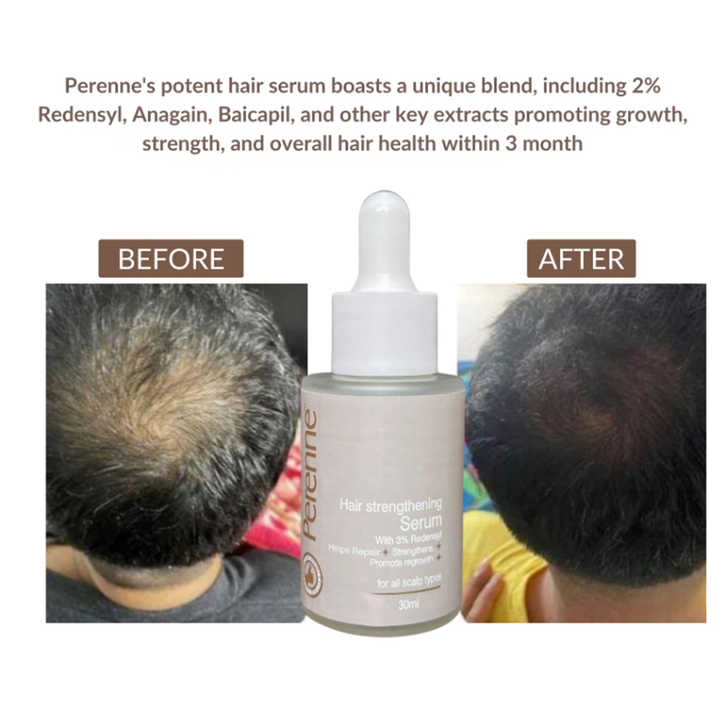 Perenne Hair Strengthening Serum With Redensyl