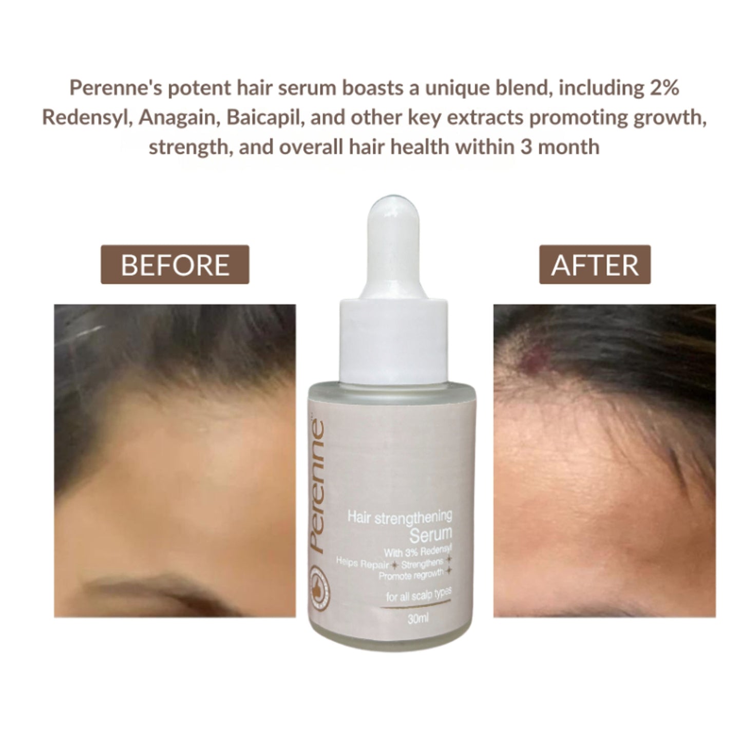 Perenne Hair Strengthening Serum With Redensyl