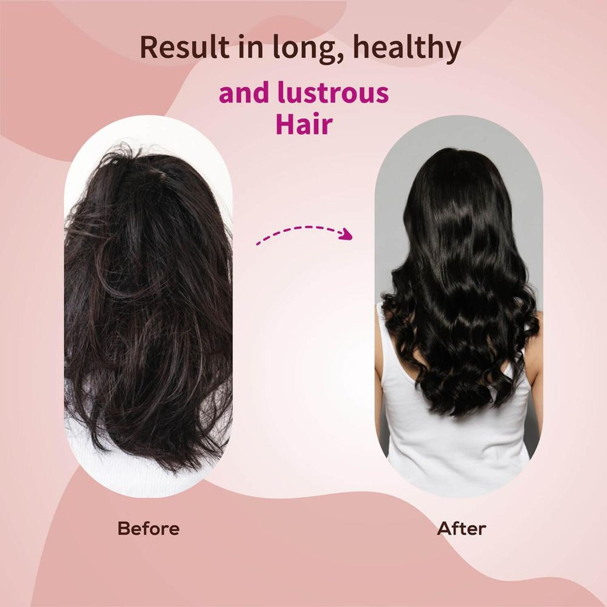 Anti-Hair Fall Shampoo with Neem, Shikakai & 25+ Botanicals to Strengthen Roots & Reduce Hair Fall