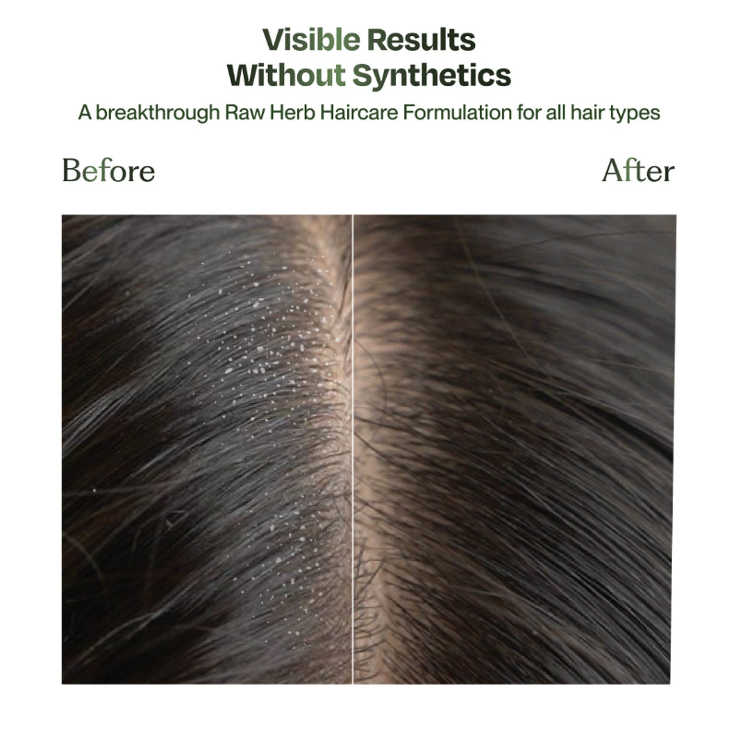 Sacred Grove Neem Anti-Dandruff Hair Mask Plant based Intense Dandruff Treatment for flaky scalp