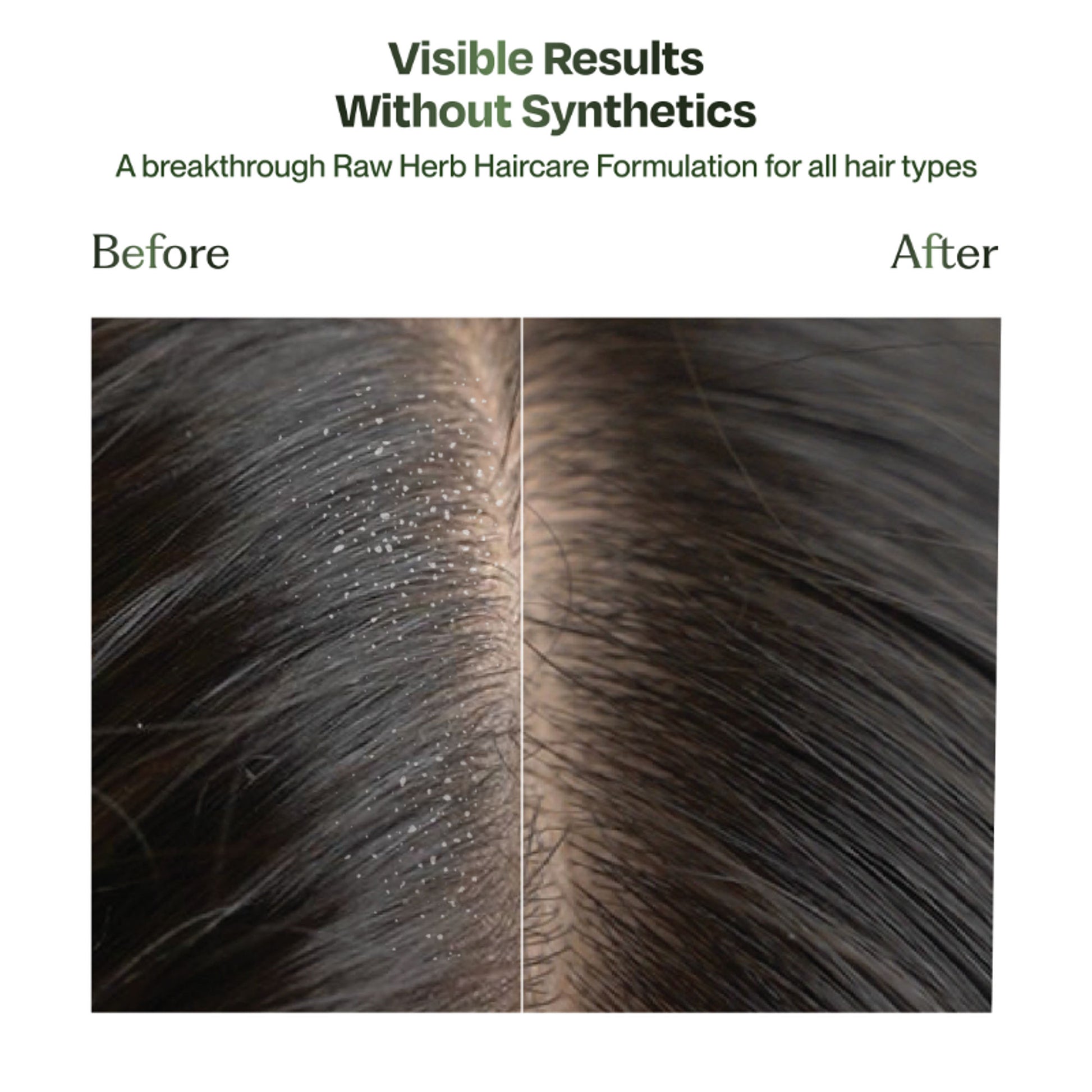 Sacred Grove Neem Anti-Dandruff Hair Mask Plant based Intense Dandruff Treatment for flaky scalp