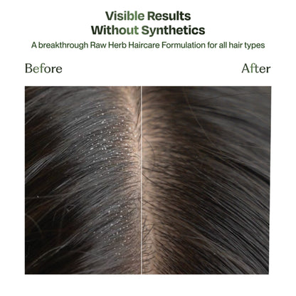 Sacred Grove Neem Anti-Dandruff Hair Mask Plant based Intense Dandruff Treatment for flaky scalp