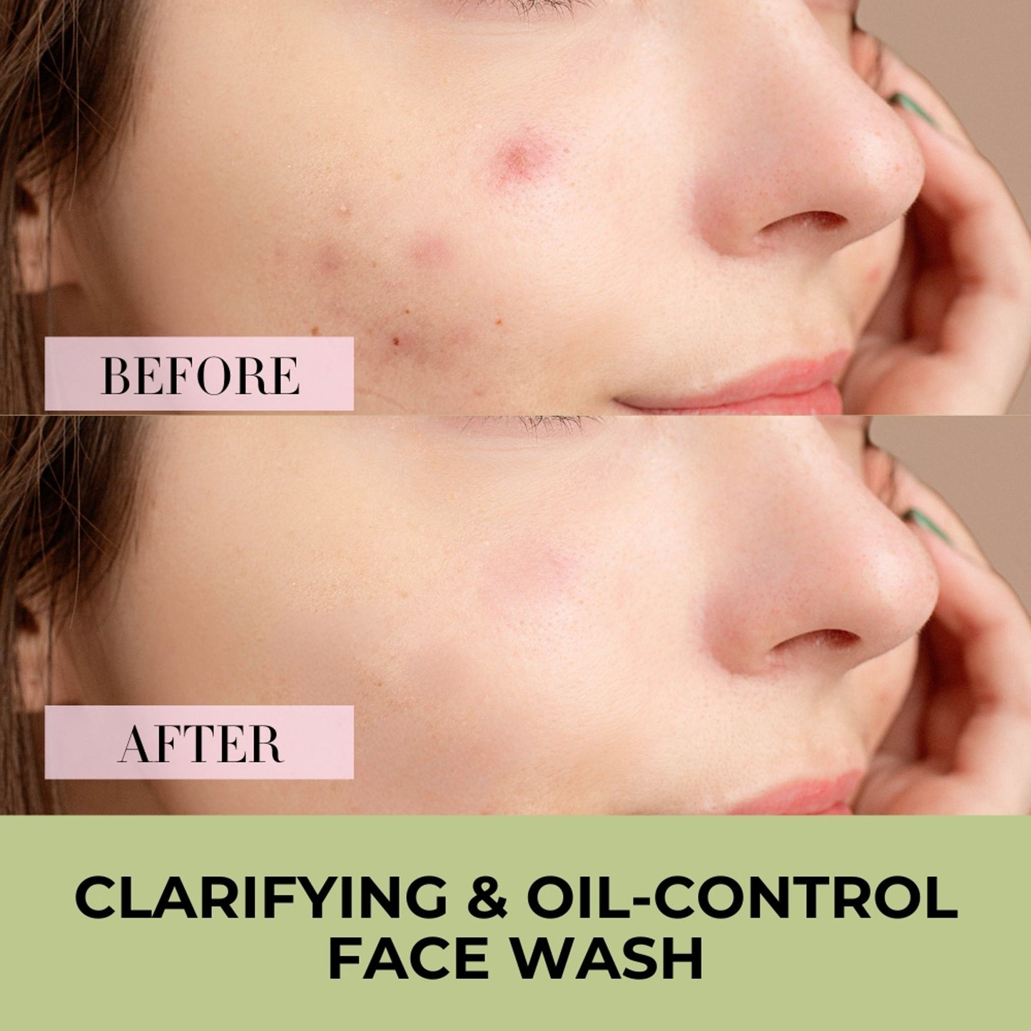 Baes Club Tea Tree, Neem & Aloe Vera Face Wash With Vitamin E For Acne & Oil Control Unisex