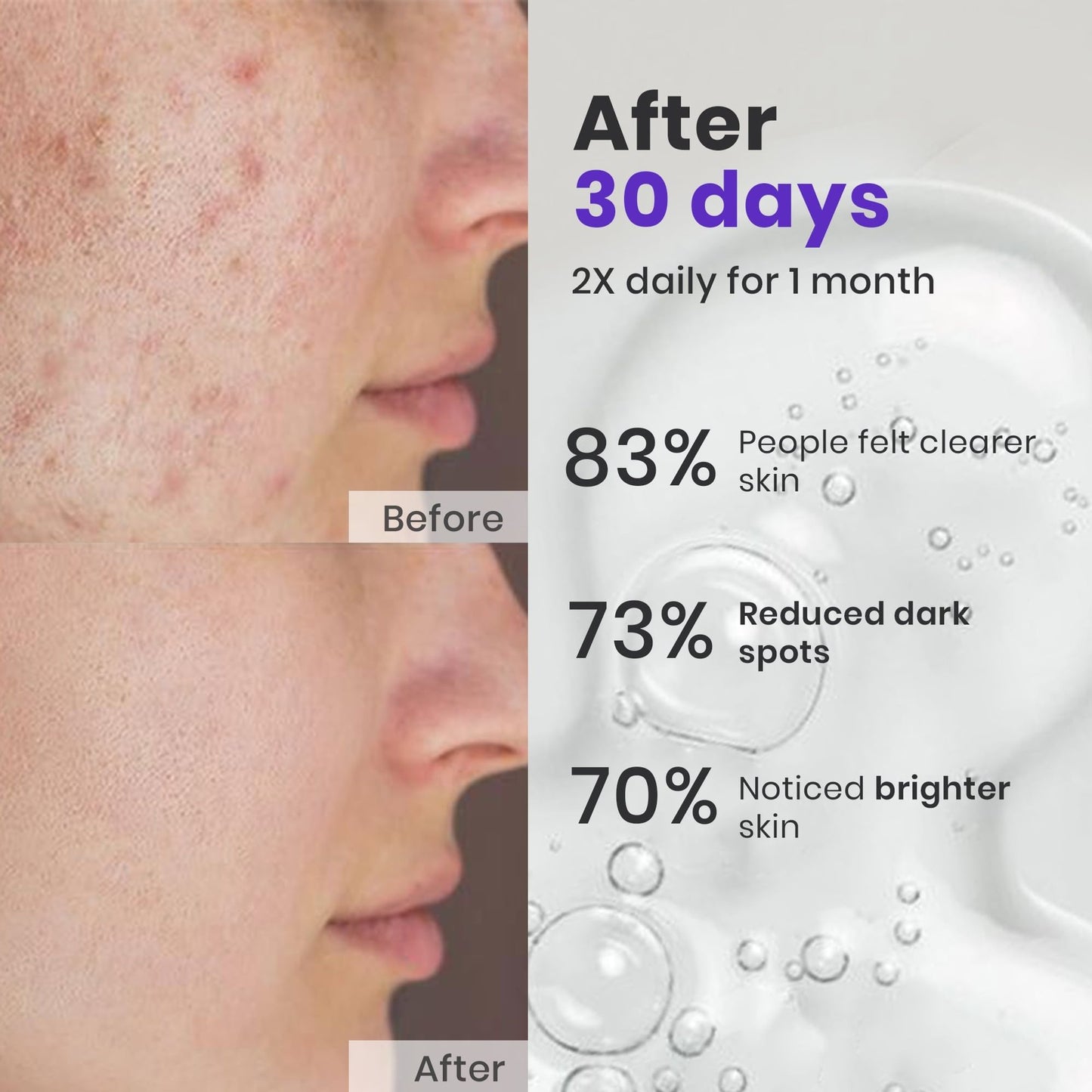 Saffrn Face Spot Corrector