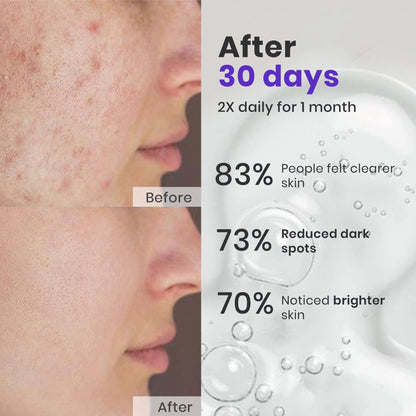 Saffrn Face Spot Corrector