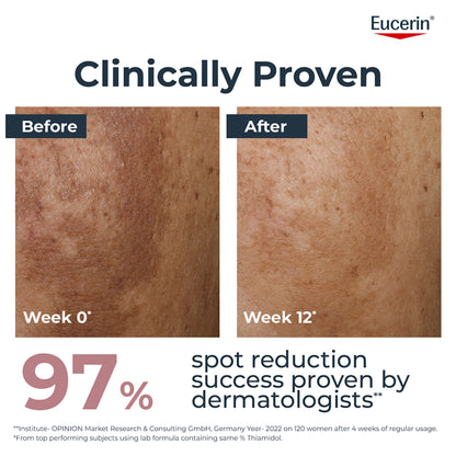 Eucerin Anti-Pigment Face Illuminating Serum With Thiamidol & Hyaluronic Acid, Reduces Dark Spots