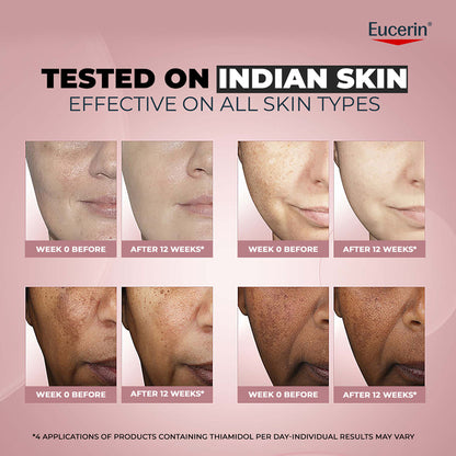 Eucerin Anti-Pigment Face Illuminating Serum With Thiamidol & Hyaluronic Acid, Reduces Dark Spots