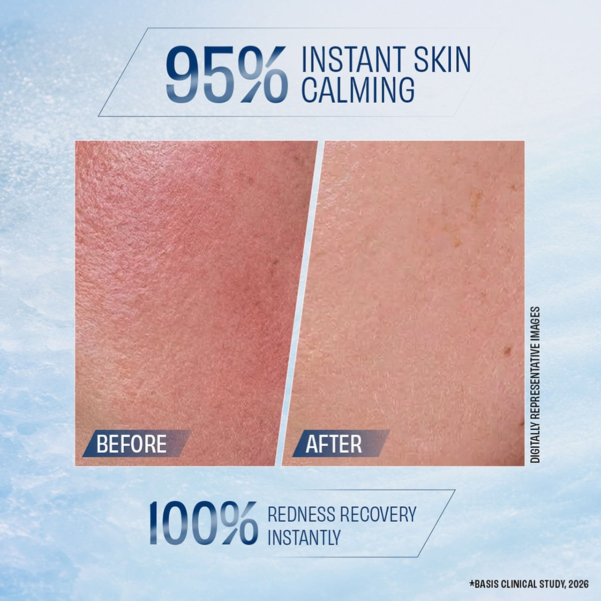 Ponds Biome Miracle Freeze Recovery Moisturizer Gel, for 95% Calmer Skin