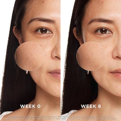 Lancome Renergie Triple Serum For Face