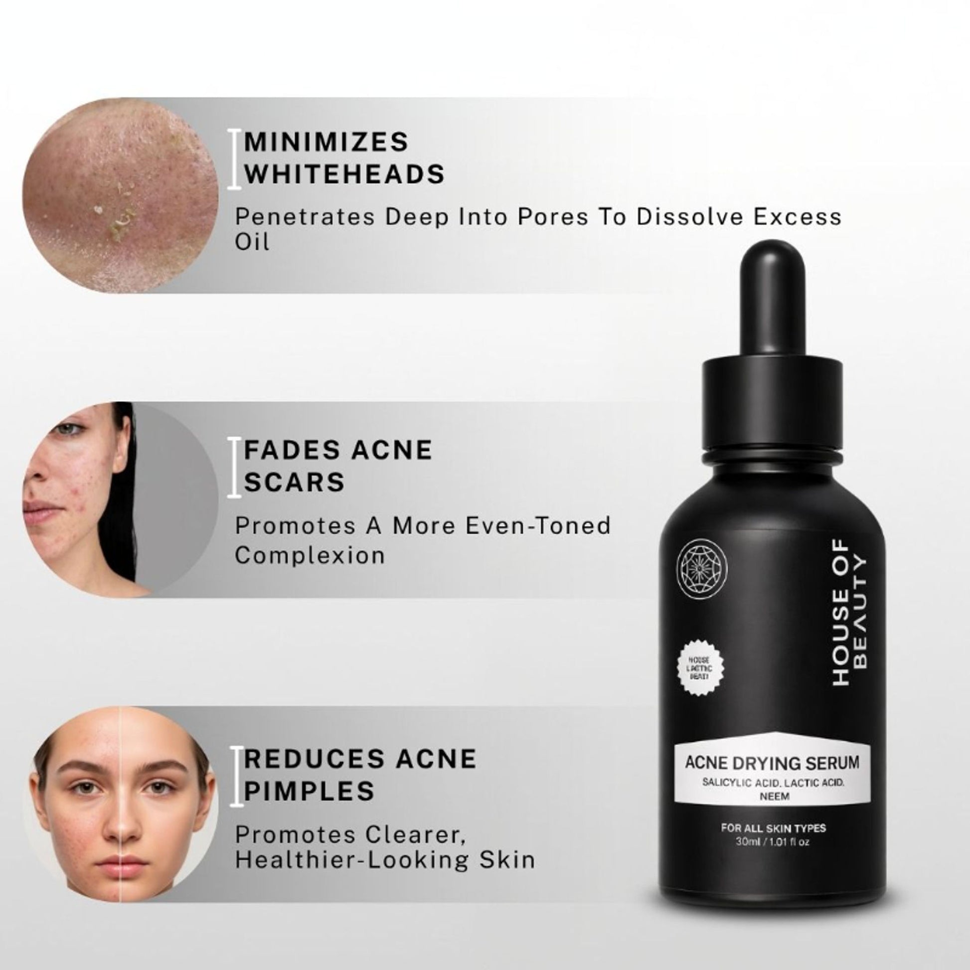 House Of Beauty Acne Drying Serum