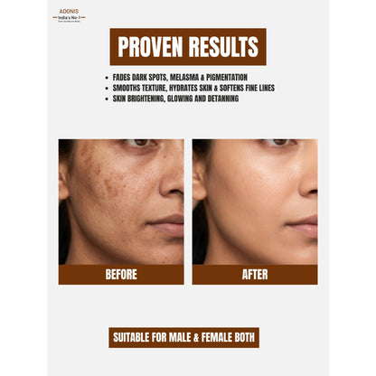 Adonis Unisex Adowhite Advance Face Serum With Kojic Acid & Glutathione For Pigmentation-Brightening