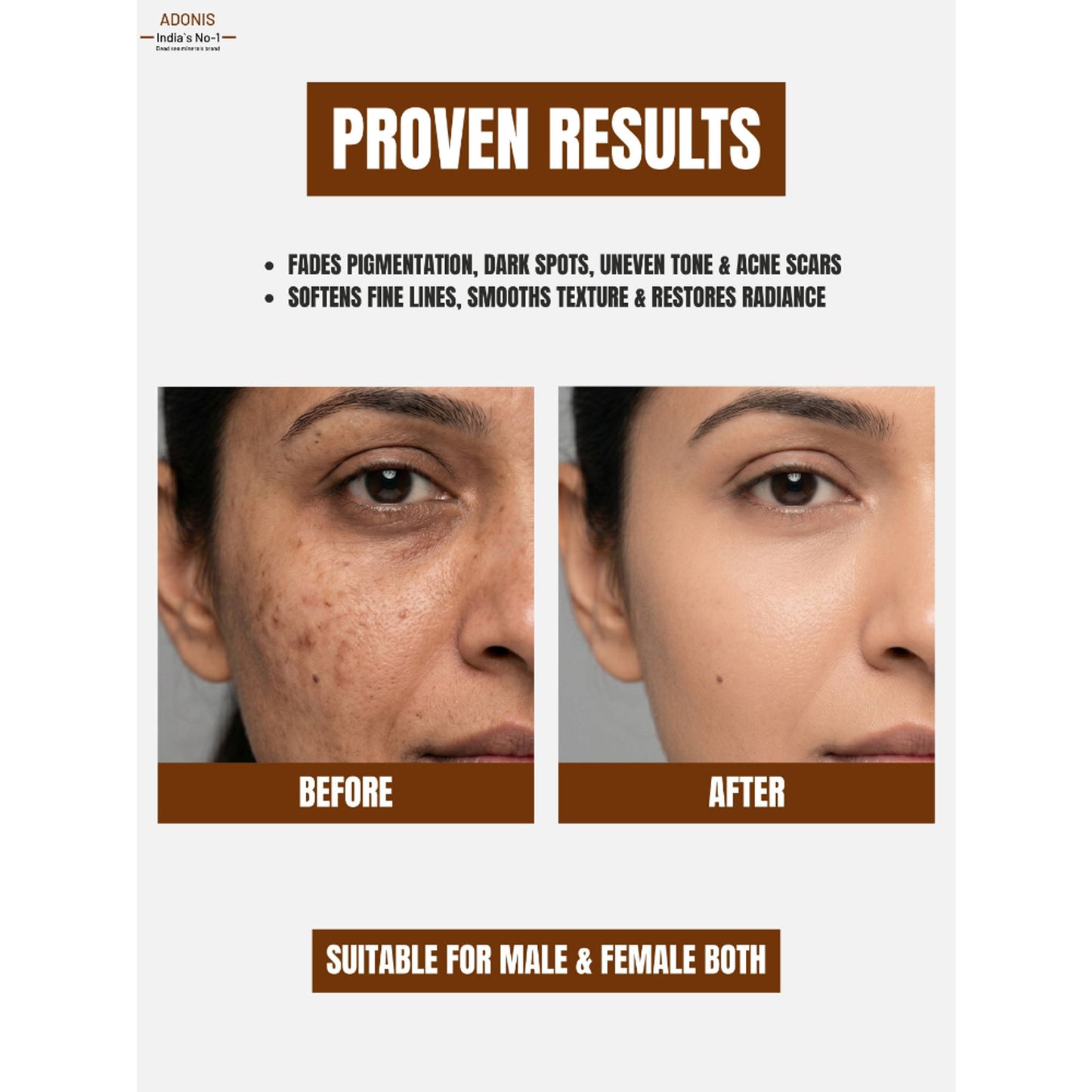 Adonis Unisex Adozelic AZ Face Serum with Azelaic Acid & Niacinamide for Pigmentation & Even Tone